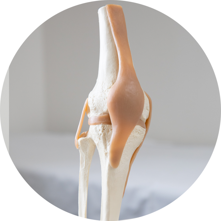 knee-arthroscopy-central-coast-dr-simon-hutabarat